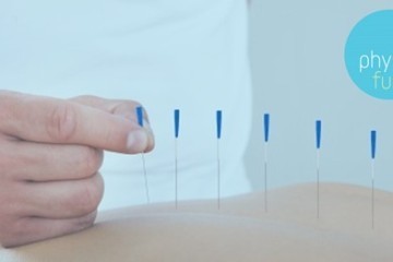 accupuncture.jpg