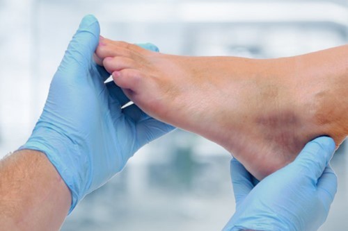 ankle-bruise.jpg