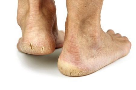 foot-heels.jpg