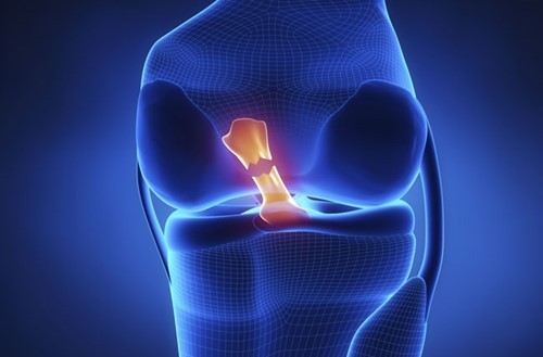 posterior_cruciate_ligament_graphic_1.jpg