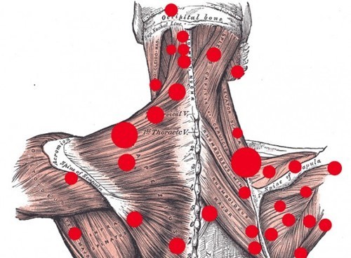 trigger-points.jpg